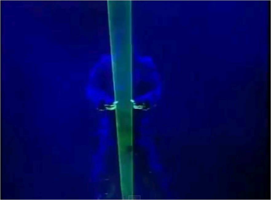 best laser act jaipur